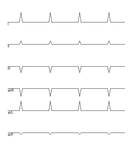 EKG zur Abfrage