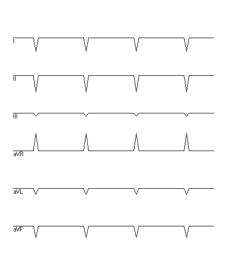 EKG zur Abfrage