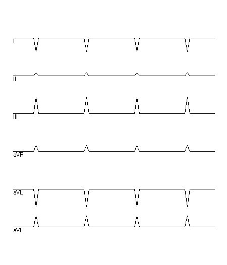 EKG zur Abfrage