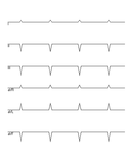 EKG zur Abfrage