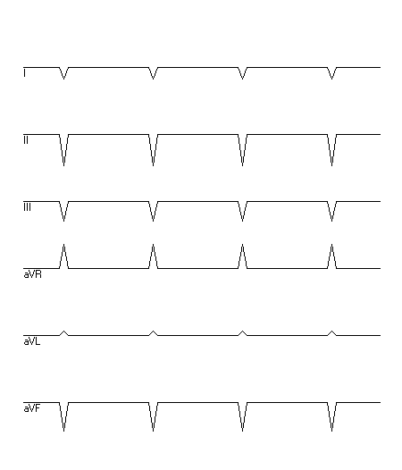 EKG zur Abfrage