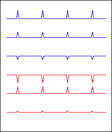 Stilisiertes EKG