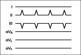 Lernkarte