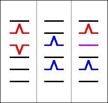 Zwischentyp im EKG